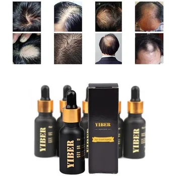 1 gabalas 20 ML natūralių plaukų augimo esmė, natūralus ekstraktas iš esmės, plaukų augimo esmė, eterinis aliejus, plaukų slinkimas esmė