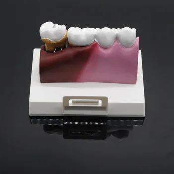 Stomatologas Lab Minkšta Guma, Dantų Modelio Dantų Protezavimo Studijų Studentų Praktika