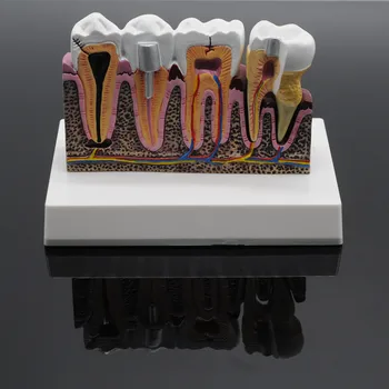 Stomatologas Lab Minkšta Guma, Dantų Modelio Dantų Protezavimo Studijų Studentų Praktika